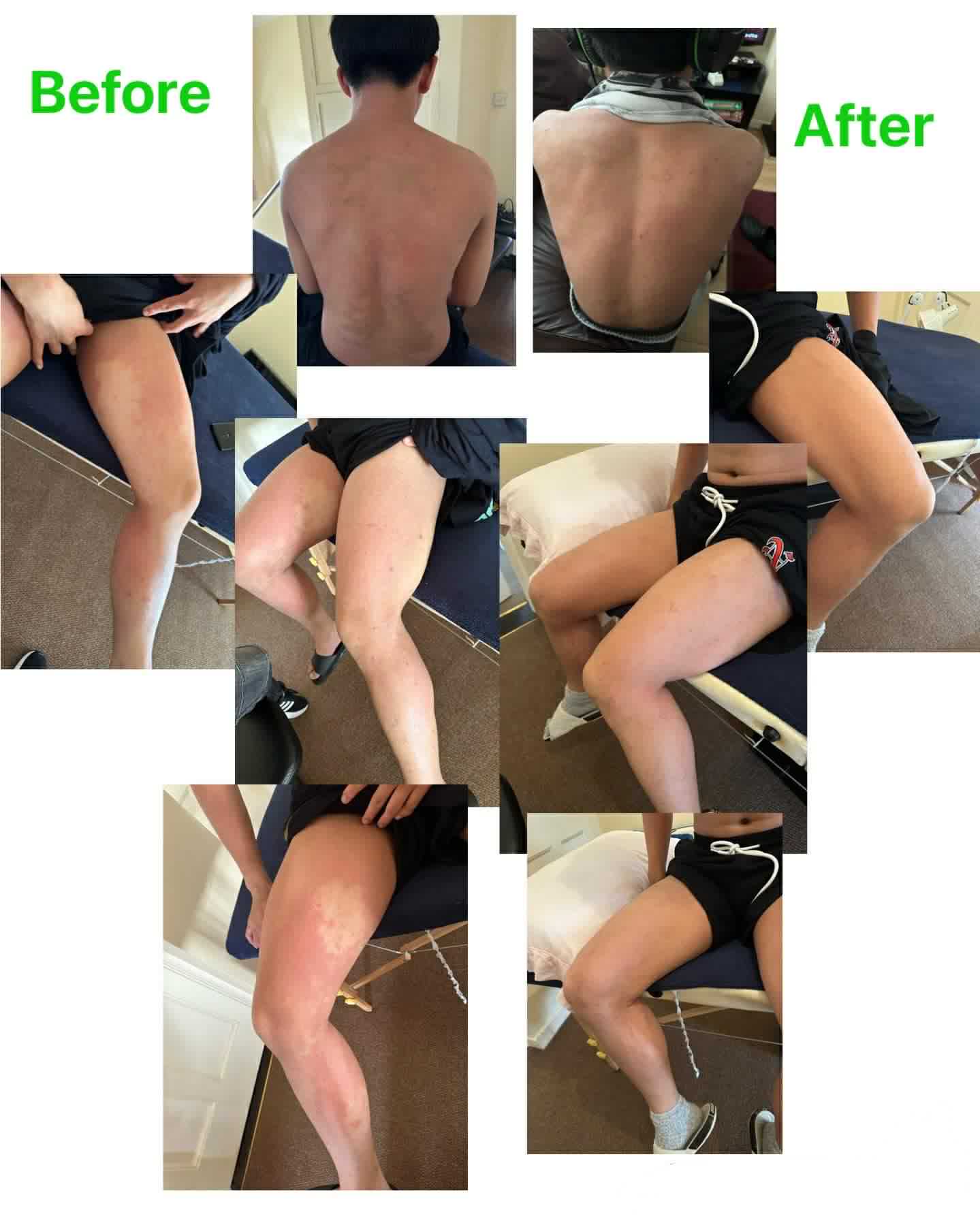 Skin treatment before and after results